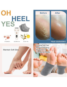 Limpiador de pies eléctrico Meyluth con 3 rodillos y 2 velocidades 2