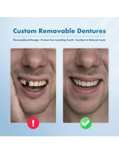 Dentaduras Removibles Personalizadas Qiivosm - 2 Dientes 2