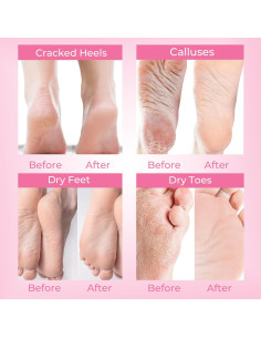 Mascarilla Exfoliante para Pies SAISZE, 4 Pares, Lavanda 2