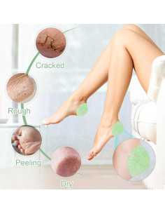 30 Parches Adhesivos para Talones Agrietados TEAWOO Aloe Vera 2