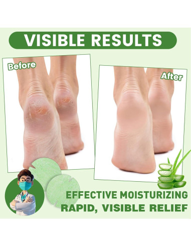 30 Parches Adhesivos para Talones Agrietados TEAWOO Aloe Vera