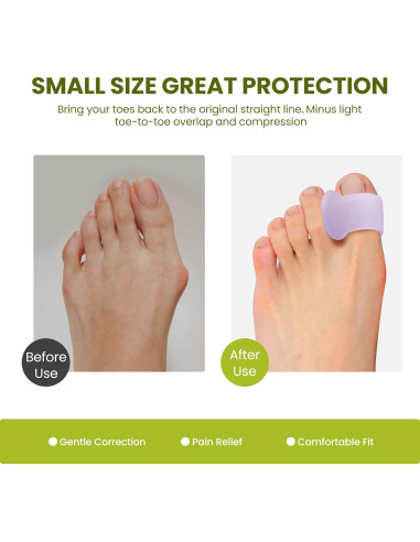 Separador de Dedos Bukihome para Juanetes - Paquete de 6