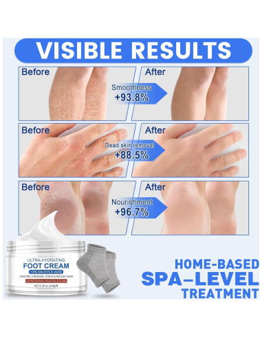 Crema para Pies Ultra Hidratante TEAWOO 150g + Calcetines