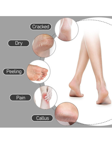 3 Pares Calcetines Hidratantes de Gel COMNICO para Talones