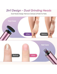 Removedor de Callos Eléctrico 2 en 1 Shenzhen FR10 Rosa 2