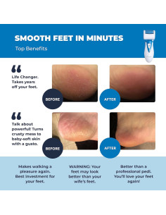 Removedor de Callos Eléctrico Own Harmony CR900 Recargable 2