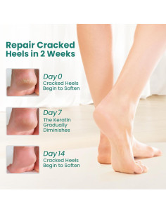 Calcetines Hidratantes Welnove - 2 Pares Aloe Vera - Extra Grande 2