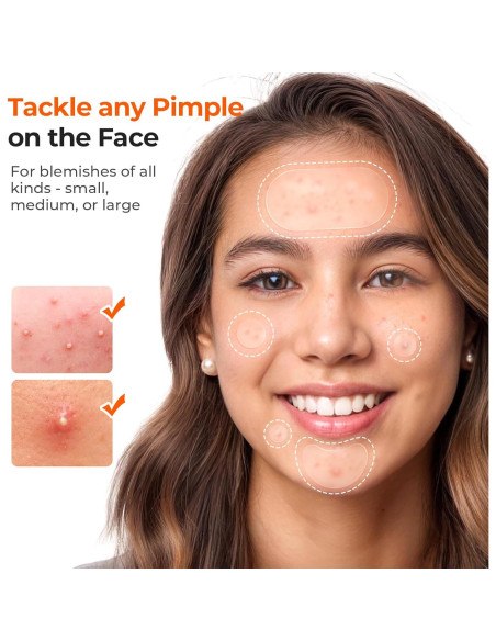 Parches para Acné TKTK Hidrocoloides 443 Piezas 5 Tamaños