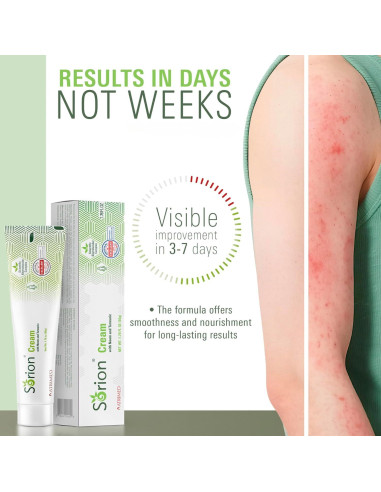 Crema Sorion Hidratante Herbal 51g - Piel Seca y Picazón