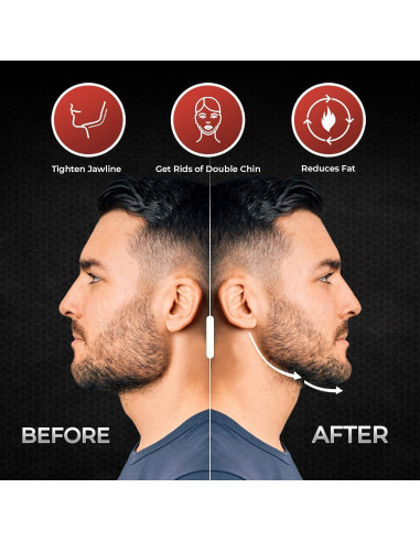 Ejercitador de Mandíbula FRIVOOD - Set 10 Piezas Silicona Resistencia