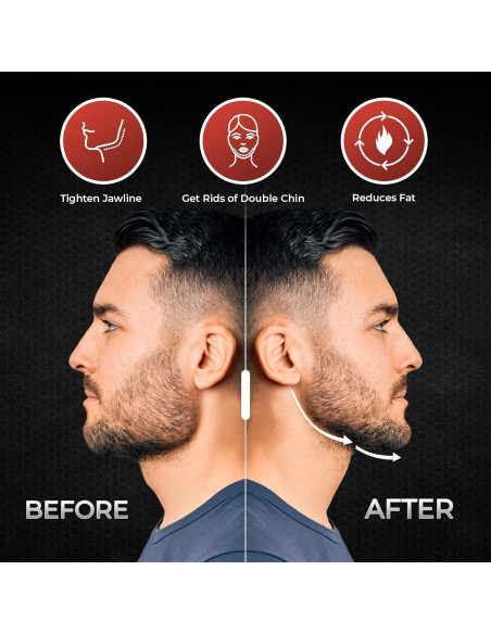 Ejercitador de Mandíbula FRIVOOD - Set 10 Piezas Silicona Resistencia