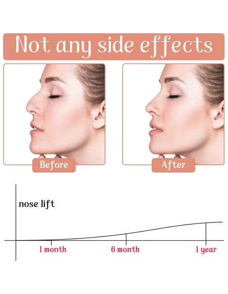 Elevadores de Nariz Nuanchu 6 Pares Silicona Invisible