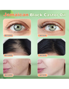 Aceite de Ricino Negro Jamaicano 56.8 ml YLXYZUAD Hidratante 2