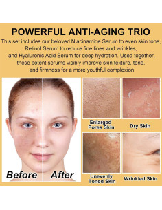 Kit Cuidado Facial GOWLAVER Antienvejecimiento 6 Piezas 2