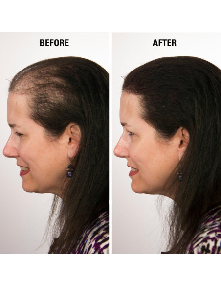 Fibras para Cabello ECLIPSE Castaño 15g Indetectables