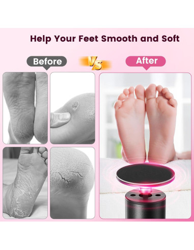 Removedor de Callos Eléctrico Inalámbrico Dsquu HX12-PK 6 Velocidades