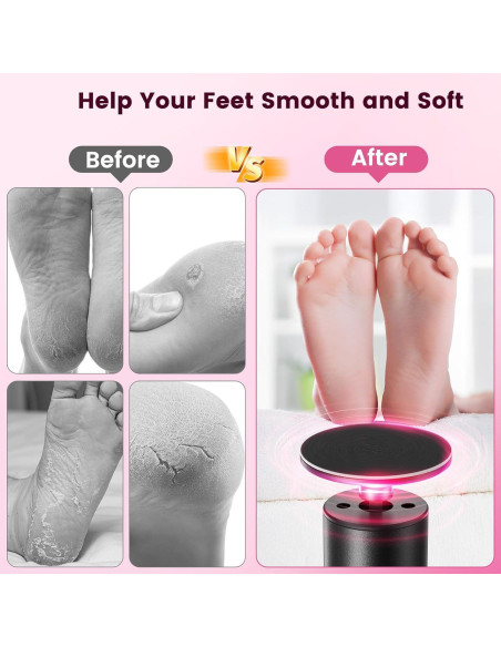 Removedor de Callos Eléctrico Inalámbrico Dsquu HX12-PK 6 Velocidades Removedor de Callos Eléctrico Inalámbrico Dsquu HX12-PK 6 Velocidades