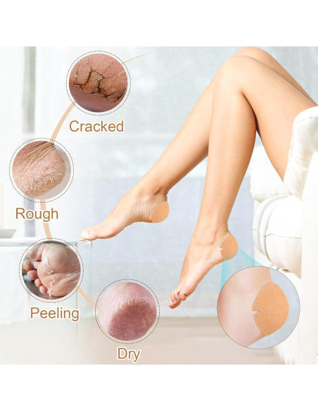 30 Parches Adhesivos TEAWOO para Talones Agrietados 80mm