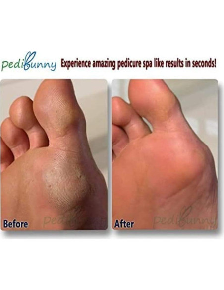 Removedor de Callos Eléctrico PediBunny PB-N45i - Recargable