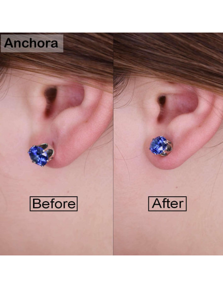 Elevadores de Pendientes Hipoalergénicos Anchora - 2 Pares Oro y Plata Elevadores de Pendientes Hipoalergénicos Anchora - 2 Pares Oro y Plata