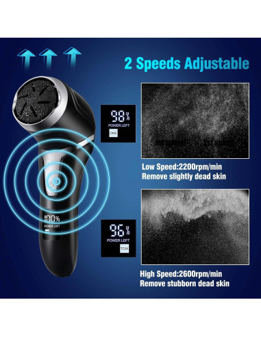 Removedor de Callos Eléctrico Yooikeey con Aspiradora y Pantalla LCD