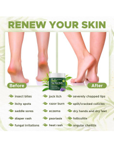 Bálsamo de Árbol de Té Owell Naturals 59 ml - Piel Seca y Agrietada 2