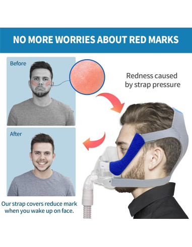 Cabezal de Reemplazo F20 Rescare con Clips y Correas Mediano