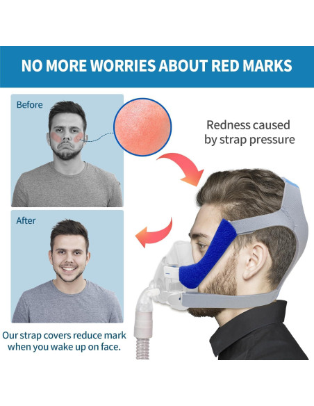 Cabezal de Reemplazo F20 Rescare con Clips y Correas Mediano