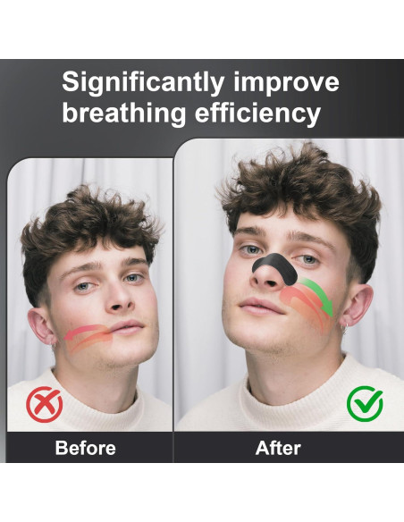 Tiras Nasales AROIC 90 Pcs Negras Antironquidos Universal