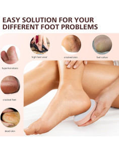 Lima de Pies de Vidrio BALUCA - Removedor de Callos Nano 2