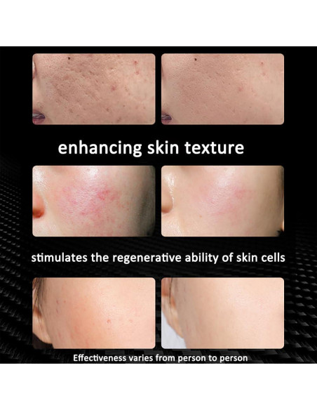 Lámpara Terapia Luz Roja U4GLORY 18 LEDs 660/850nm Ajustable Lámpara Terapia Luz Roja U4GLORY 18 LEDs 660/850nm Ajustable