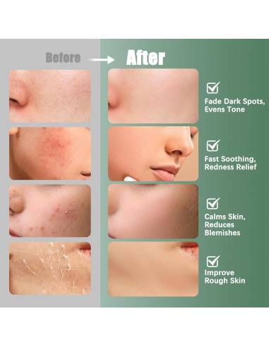 Discos de Tónico Kestper 110 Unidades con Centella Asiática