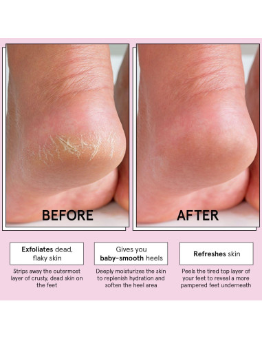 Mascarilla Exfoliante para Pies Grace & Stella - 4 Pares Sin Fragancia