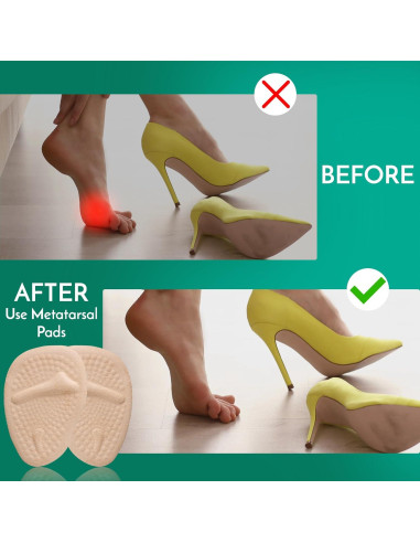 Almohadillas Metatarsales Comfwalk 3 Pares Beige - Alivio Dolor Tacones