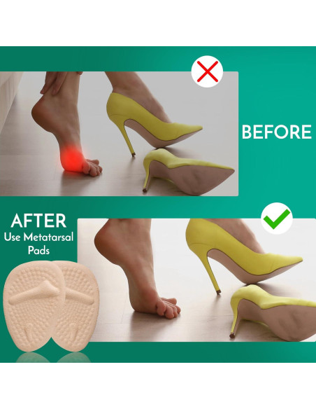 Almohadillas Metatarsales Comfwalk 3 Pares Beige - Alivio Dolor Tacones