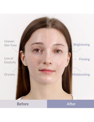 Mascarilla Facial de Gel MIZON Hyalugen - 5 Unidades Colágeno