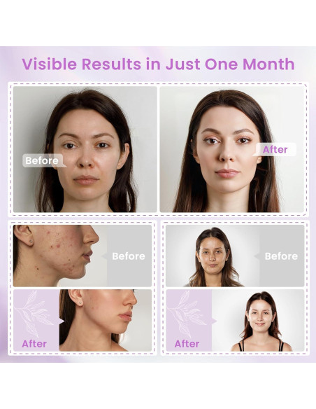 Máscara Facial LED Terapia de Luz Baiou 8-en-1 con Hielo