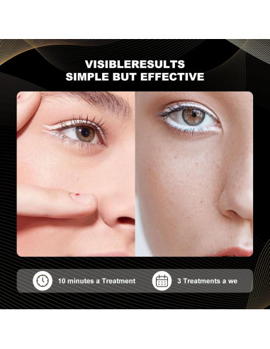 Máscara de Terapia de Luz Facial LED FAHKNS 7 Colores Recargable