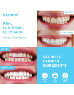Tiras Blanqueadoras de Dientes KEIDOC - 28 Tiras Naturales 2