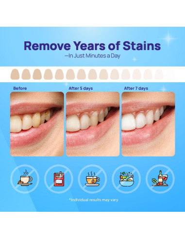 Tiras Blanqueadoras Whitebite Pro 28 Unidades - Sin Daño Esmalte