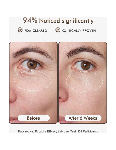 Máscara Facial de Terapia de Luz LED Rupuqira G3 - 4 Modos