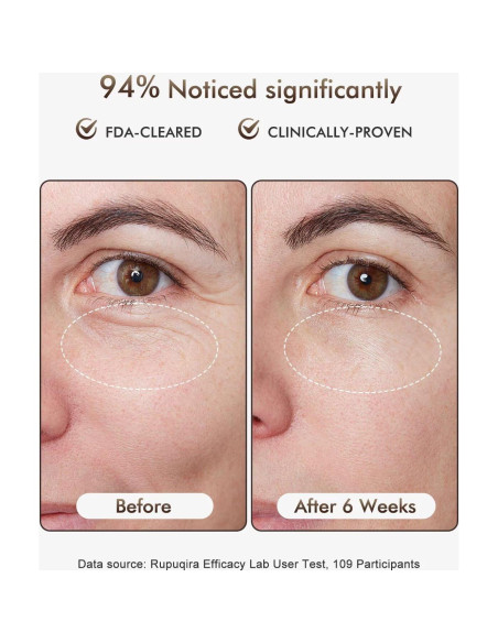 Máscara Facial de Terapia de Luz LED Rupuqira G3 - 4 Modos