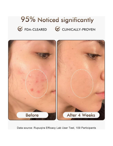 Máscara Facial de Terapia de Luz LED Rupuqira G3 - 4 Modos