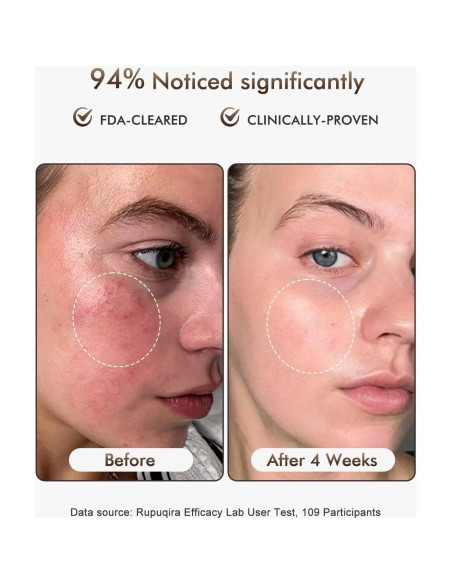 Máscara Facial de Terapia de Luz LED Rupuqira G3 - 4 Modos