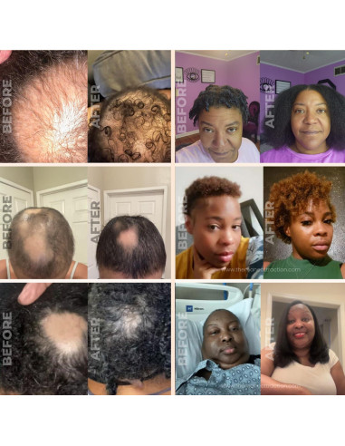 Aceite Herbal Crecimiento Capilar Extra Fuerte 118 ml - El Atractivo del Cabello