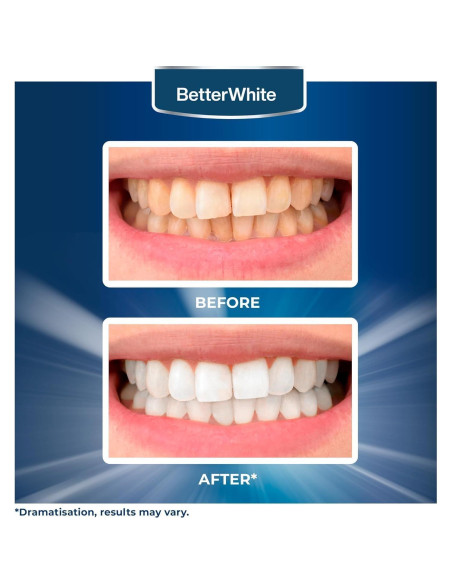 Tiras de Blanqueamiento Dental BetterWhite - 14 Tiras Naturales