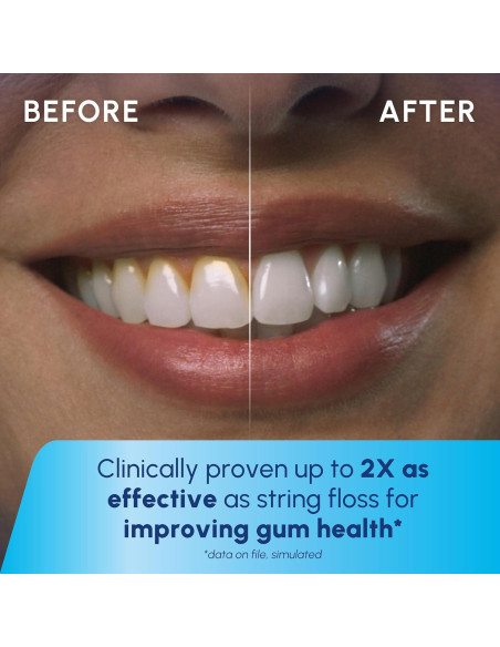 Hilo Dental Portátil Recargable Waterpik WF-20 Azul - 2 Puntas Hilo Dental Portátil Recargable Waterpik WF-20 Azul - 2 Puntas