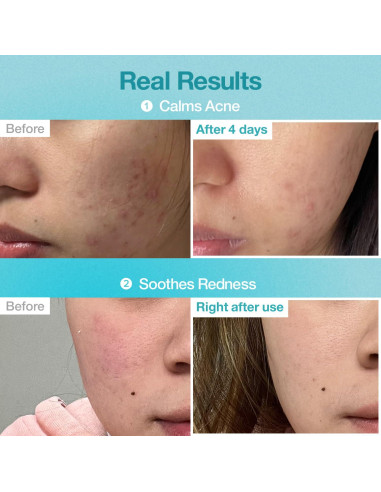 Mascarilla Facial Numbuzin No.1 Hidratante 4 Unidades