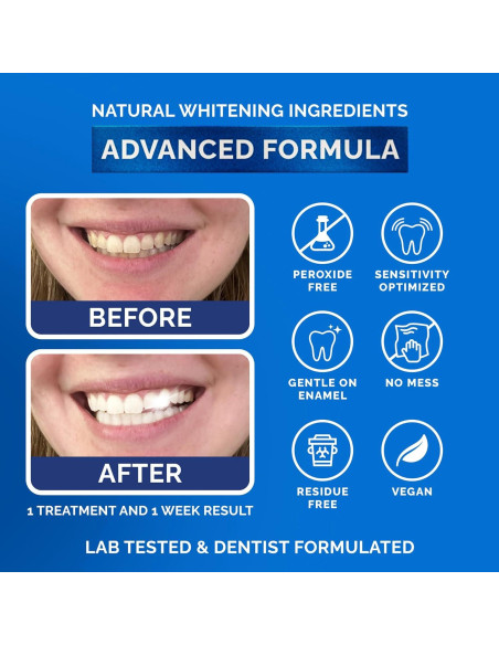 Tiras Blanqueadoras Naturales Pop On Veneers - 14 Tiras Menta