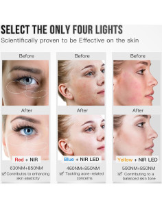 Máscara Facial LED Terapia de Luz IBORRIA 3 Colores 32x23cm 2